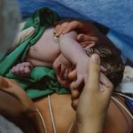 Jak umówić się na cesarskie cięcie, procedura krok po kroku